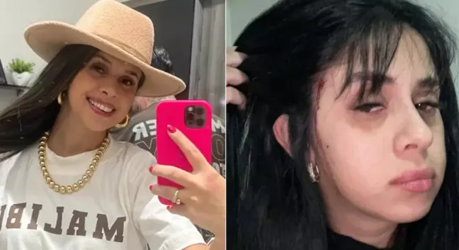 Cantora sertaneja tem cabelo cortado em frente de casa por criminosos; veja vídeo