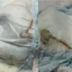 Mãe encontra rato morto dentro na fralda de recém-nascido no Rio de Janeiro
