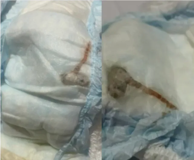 Mãe encontra rato morto dentro na fralda de recém-nascido no Rio de Janeiro
