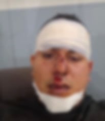 Assessor da Prefeitura de Mari diz que foi jogado do palco durante show de Ranniery Gomes; veja vídeo