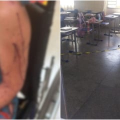 Professora é atacada com faca por aluna de 14 anos durante aula; vítima já havia recebido ameaça
